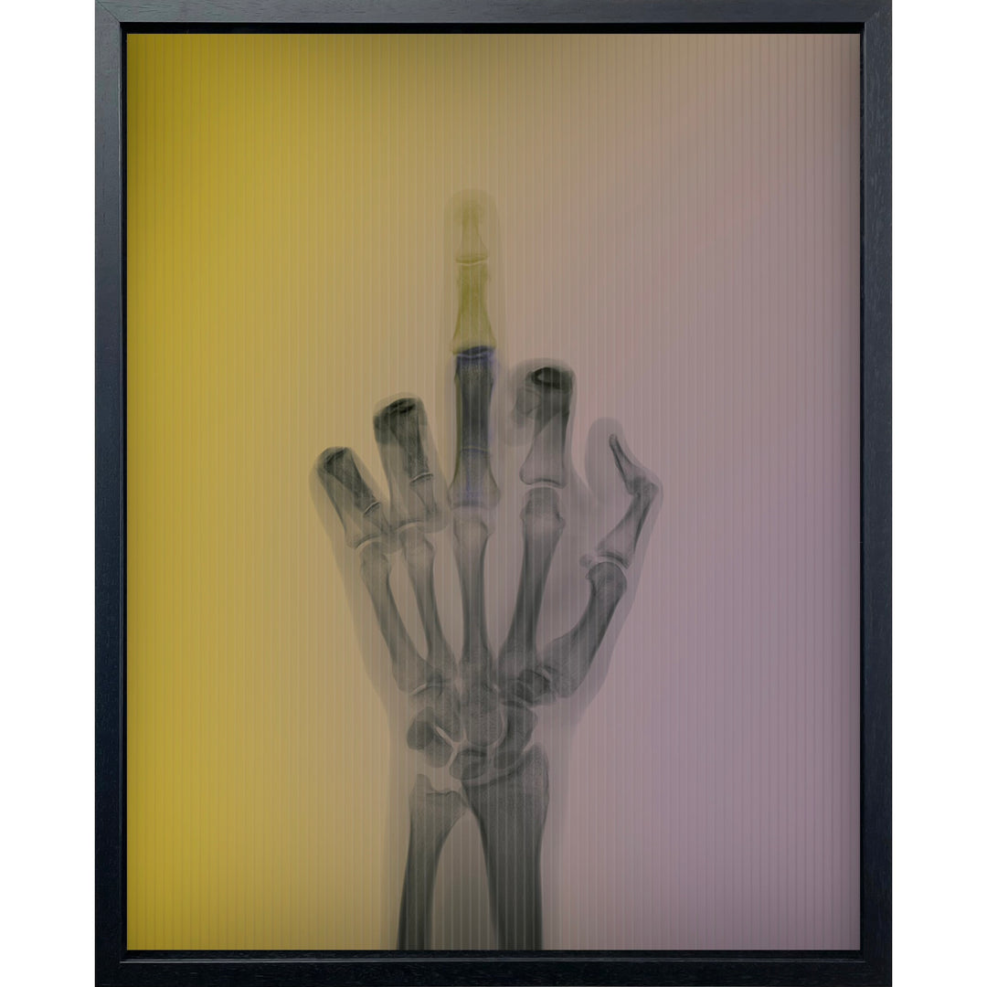 x ray hand with middle finger going up and down as color in background gradient transitioned from yellow to purple in background