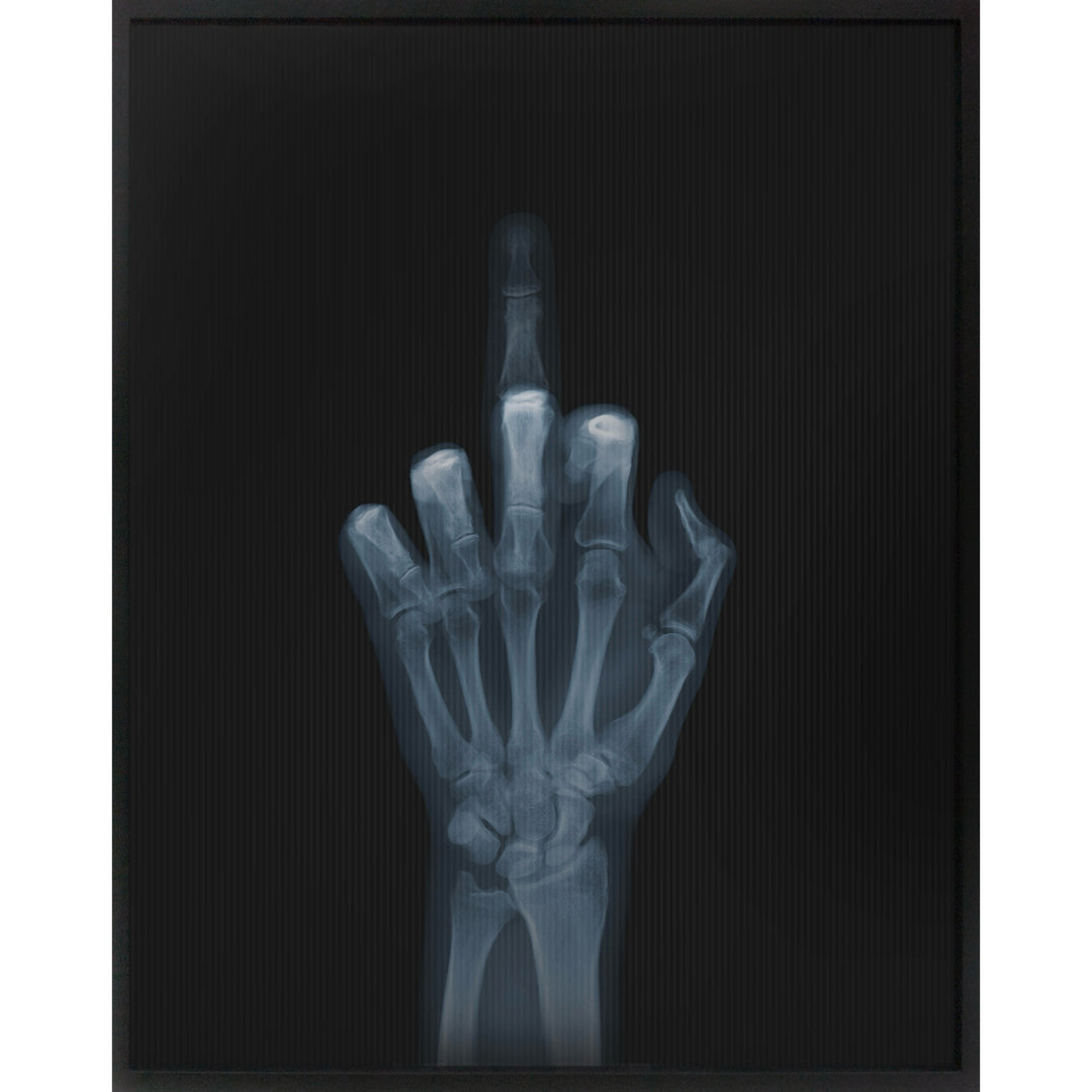 Framed Lenticular black and white x-ray photograph by Nick Veasey of a skeletal hand flipping the bird to the camera, middle finger is moving up and down 